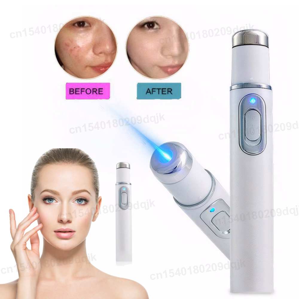 Acne Light Therapy Pen - Terapi Cahaya Biru Pena Jerawat Pemijat